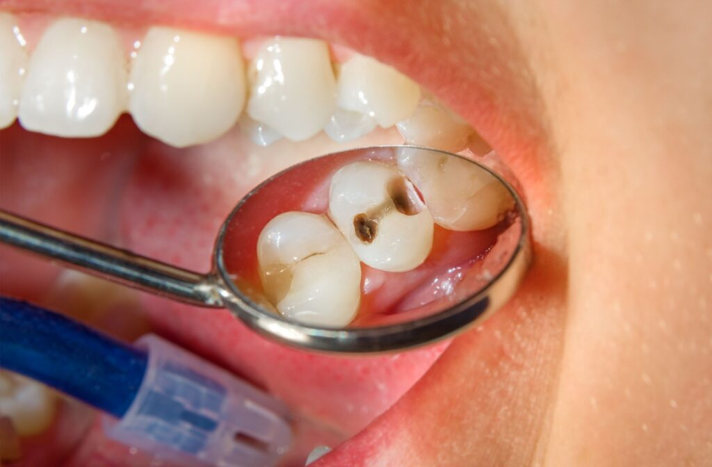 dental care in Agoura Hills